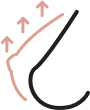 Breast Lift